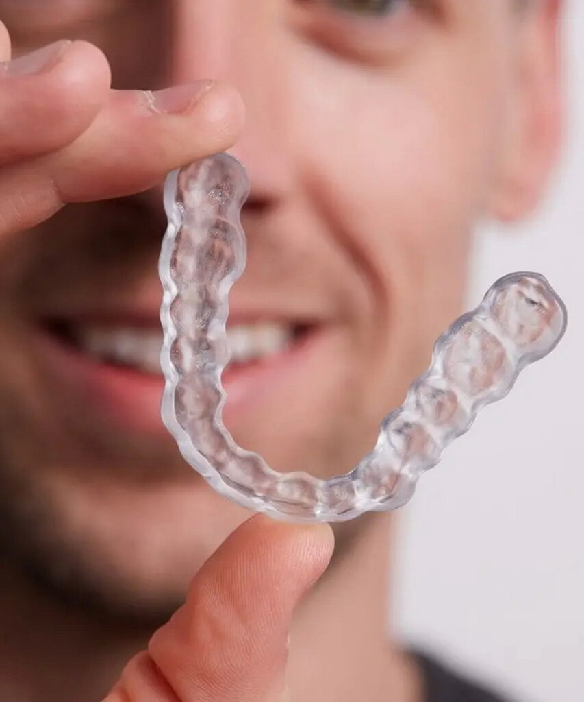 Ένας διαφανής ορθοδοντικός νάρθηκας που παρουσιάζει την ακρίβεια της 3D εκτύπωσης στην οδοντιατρική.