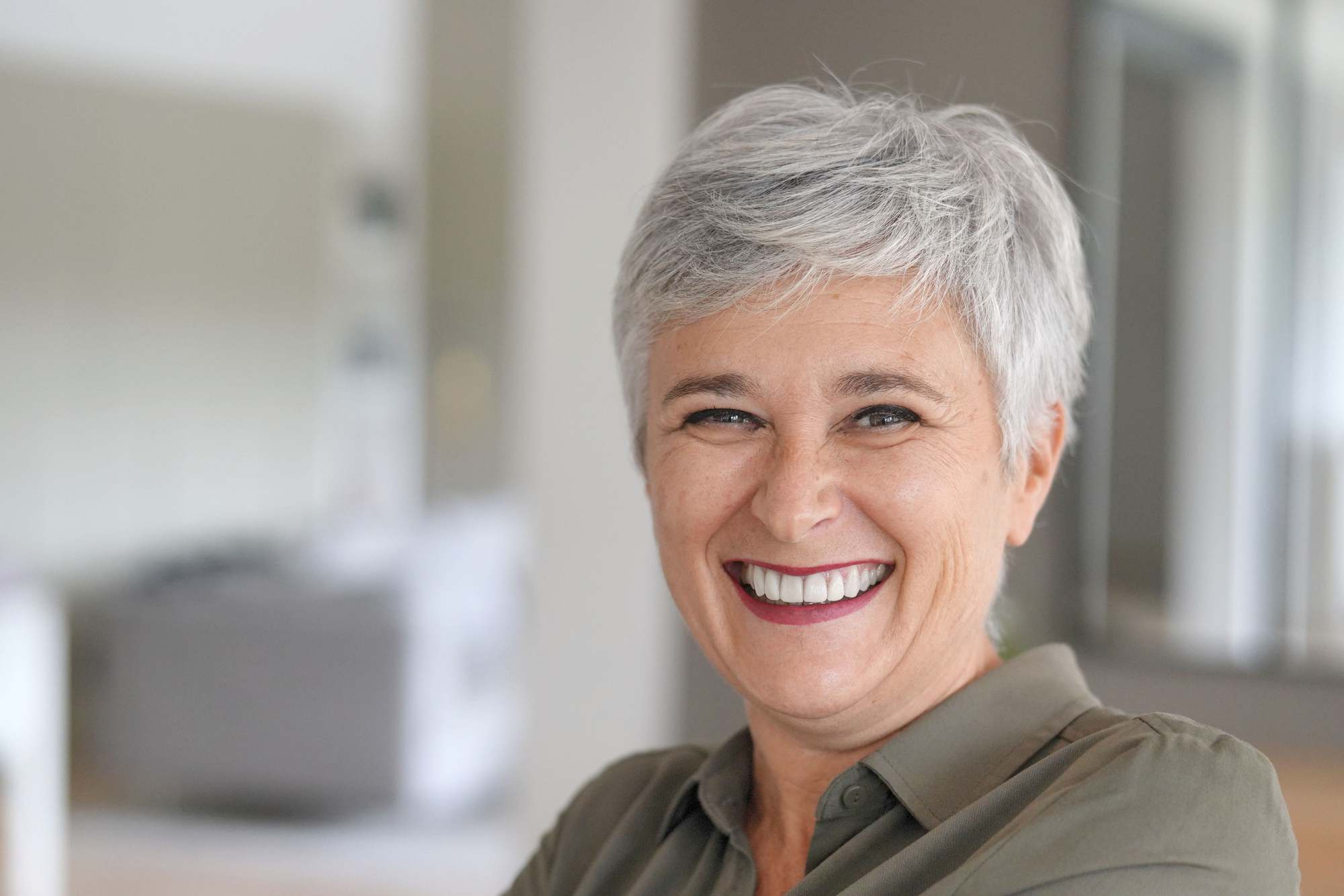 Η γυναίκα δείχνει το φυσικό αποτέλεσμα μετά την ανύψωση ιγμορείου για εμφυτεύματα.